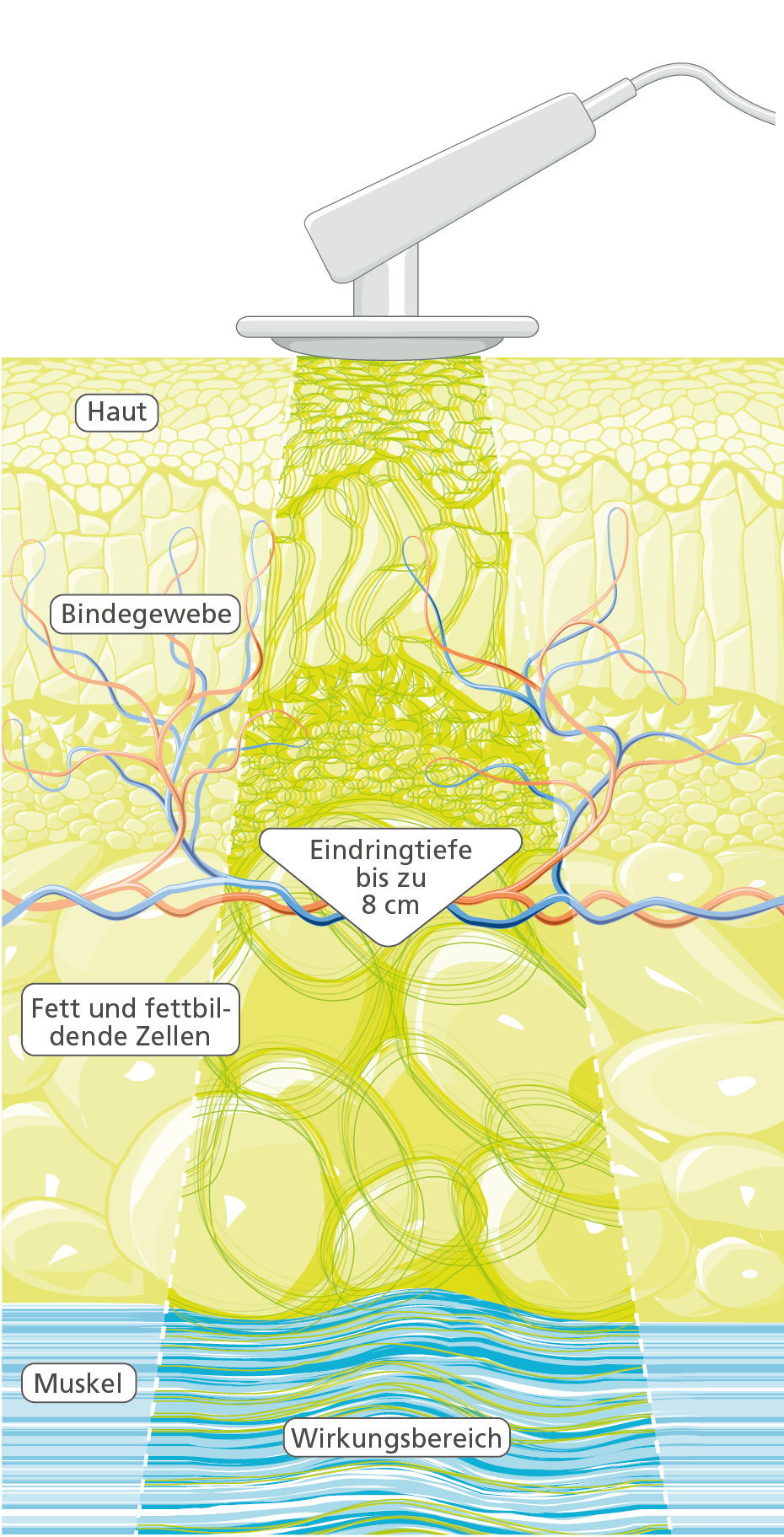 Tiefenoszillation_Grafik - PHYSIOMED