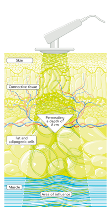 Schematic_view_DO_hp_gb (1) - PHYSIOMED